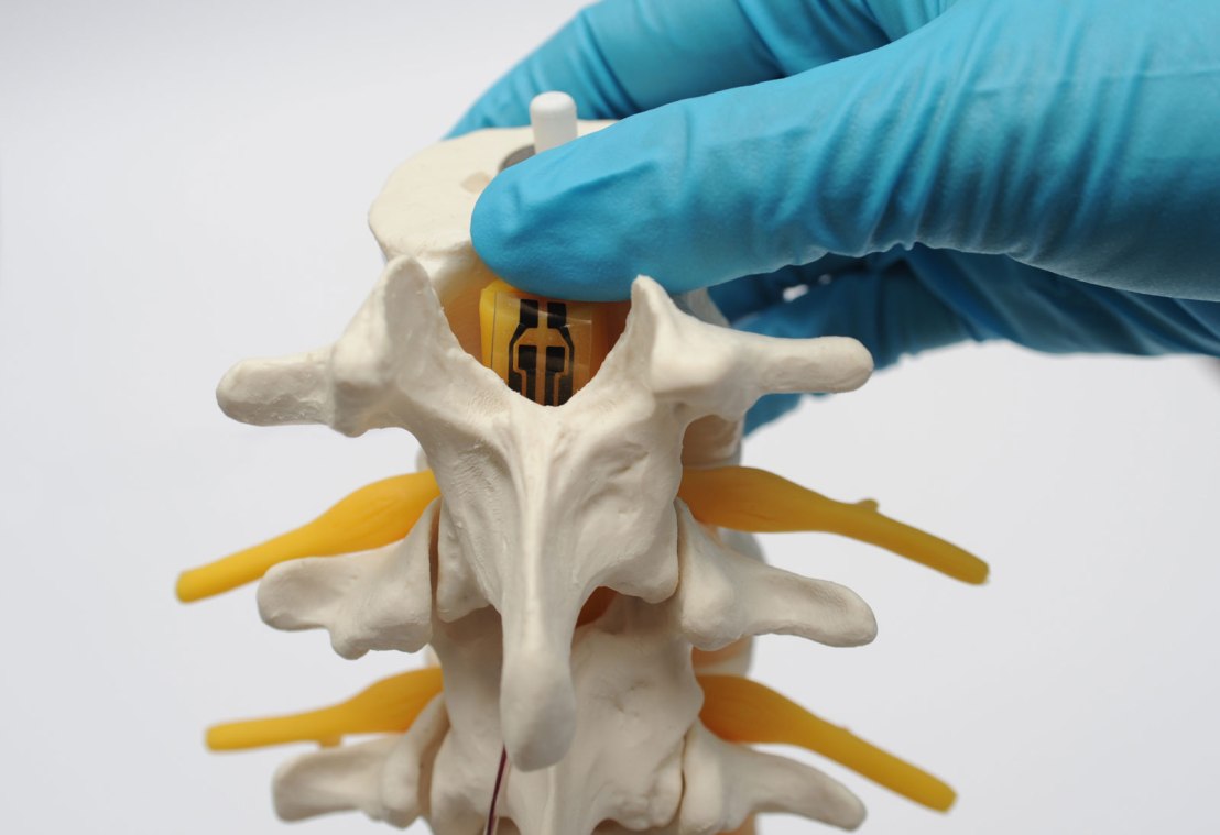 WISE la start up biomedicale contro il dolore cronico