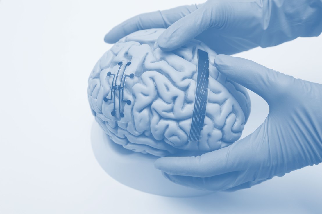 Wise start up biotech brain